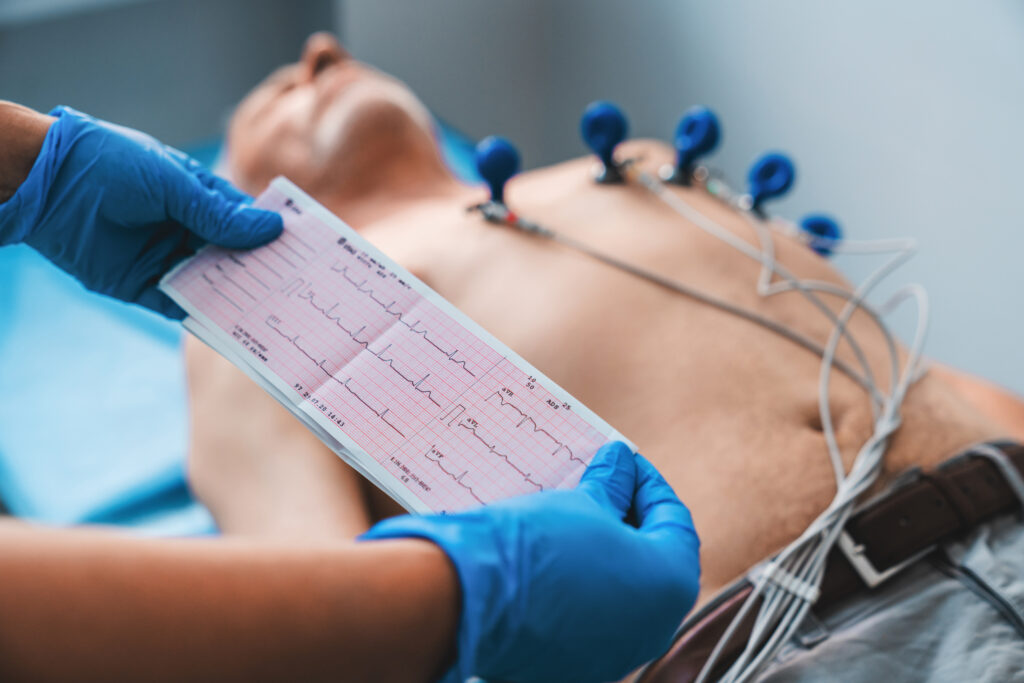 Do This To Become an EKG Tech in 2024