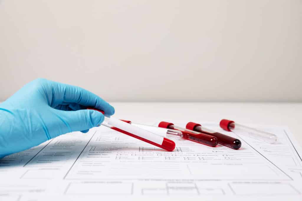 How To Become a Phlebotomist